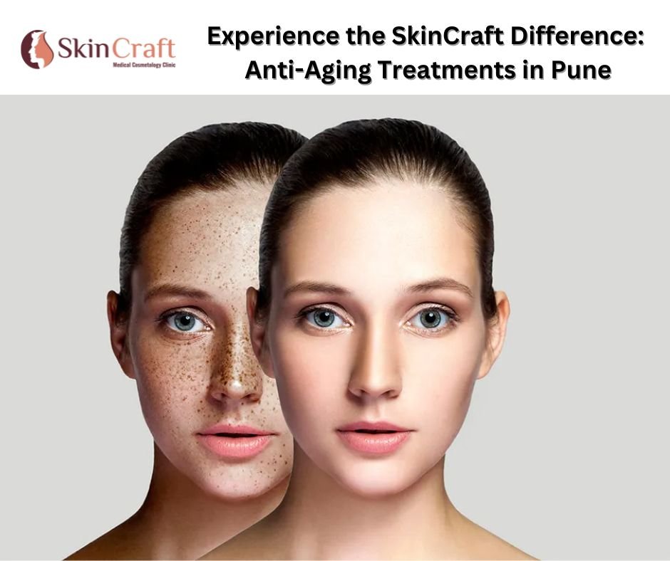 Experience the SkinCraft Difference: Anti-Aging Treatments in Pune