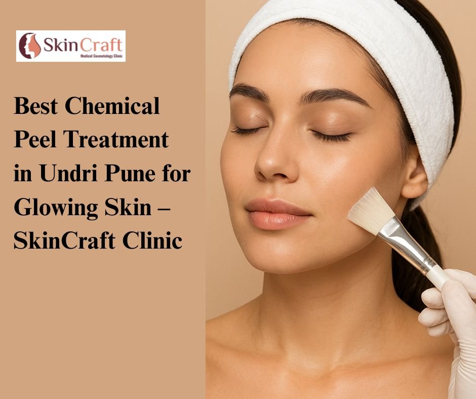 Best Chemical Peel Treatment in Undri Pune for Glowing Skin – SkinCraft Clinic