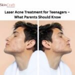 Laser Acne Treatment for Teenagers – What Parents Should Know