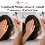 Scalp Health Matters: Advanced Dandruff Treatments at SkinCraft Pune