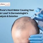 Is Pune’s Hard Water Causing Your Hair Loss? A Dermatologist’s Analysis & Solution