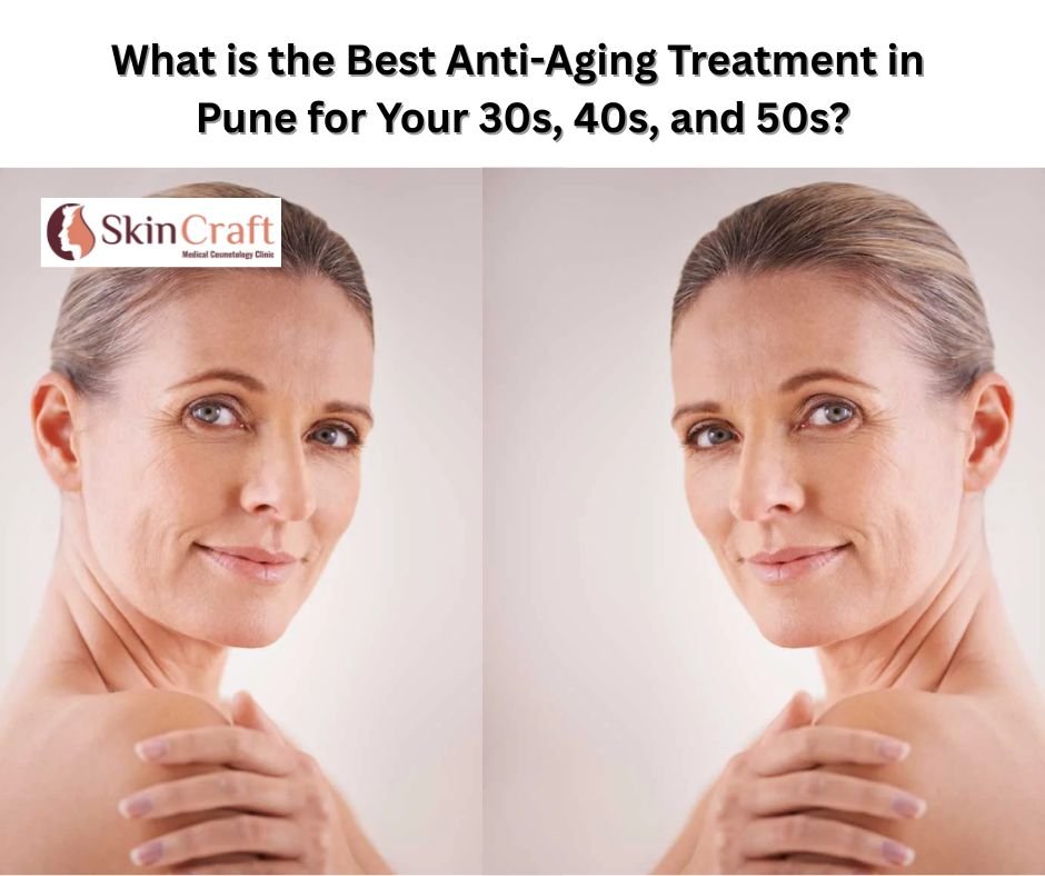 What is the Best Anti-Aging Treatment in Pune for Your 30s, 40s, and 50s?