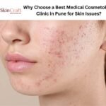 Why Choose a Best Medical Cosmetology Clinic in Pune for Skin Issues?