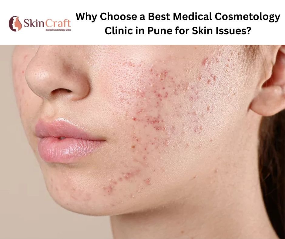 Choose a Best Medical Cosmetology Clinic in Pune for Skin Issues
