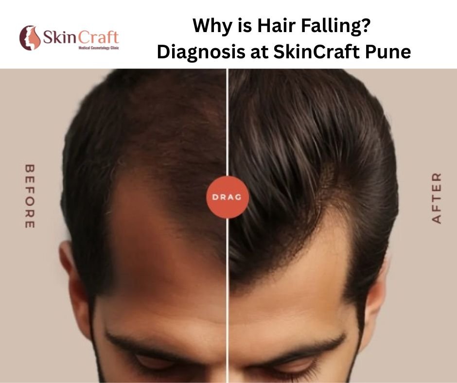 Hair Loss Treatment In Pune: Expert Diagnosis