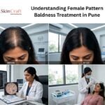 Understanding Female Pattern Baldness Treatment in Pune